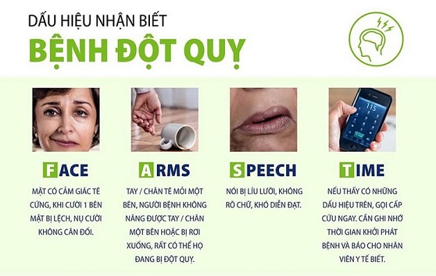 dấu hiệu nhận biết bệnh tai biến mạch máu não (đột quỵ)