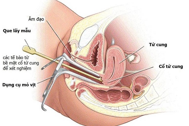khám phụ khoa thế nào