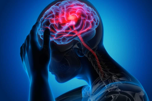 Nguyên nhân bệnh động kinh một nửa là do các tổn thương ở não