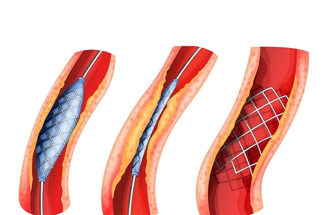 Trong quá trình điều trị cũng có thể xảy ra một số rủi ro