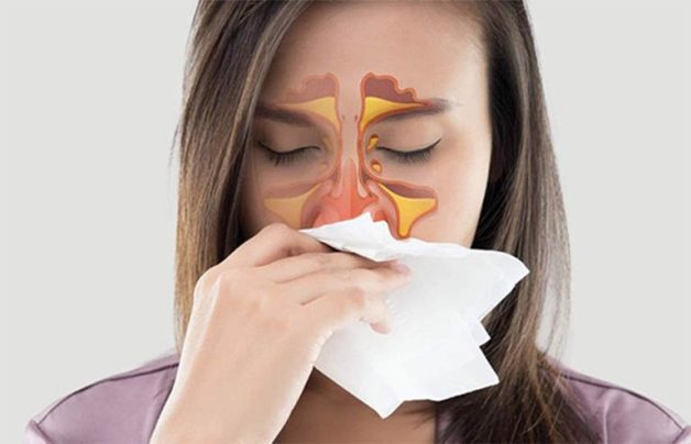 viêm hầu họng giả mạc là bệnh hiếm gặp