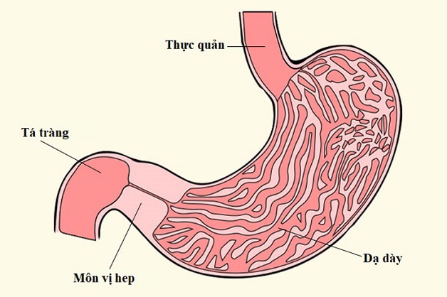 Biến chứng của viêm loét dạ dày
