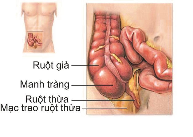 biến chứng