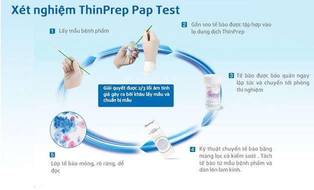 xét nghiệm thinprep
