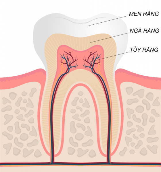 sâu tủy răng