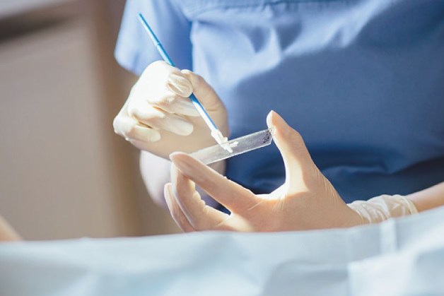 xét nghiệm pap và hpv