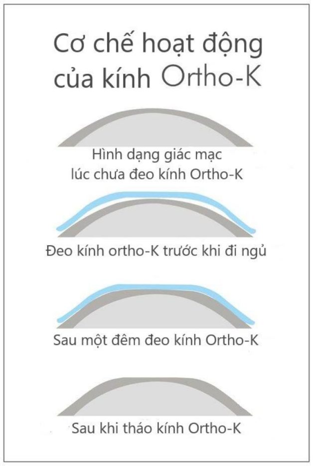 bệnh viễn thị