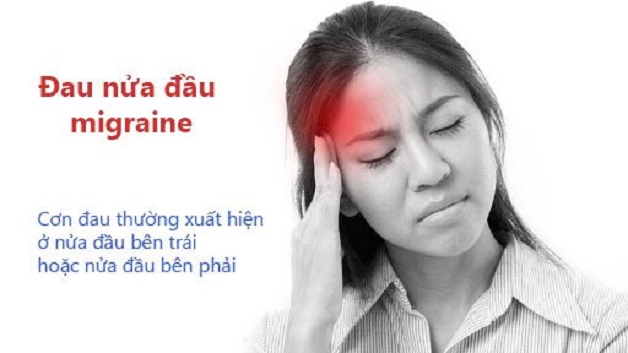 đau đầu 1 bên