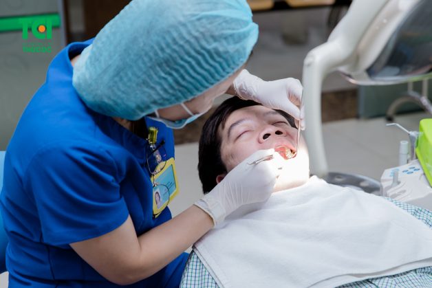 điều trị tủy răng