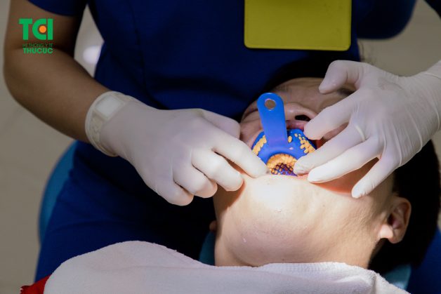 điều trị tủy răng