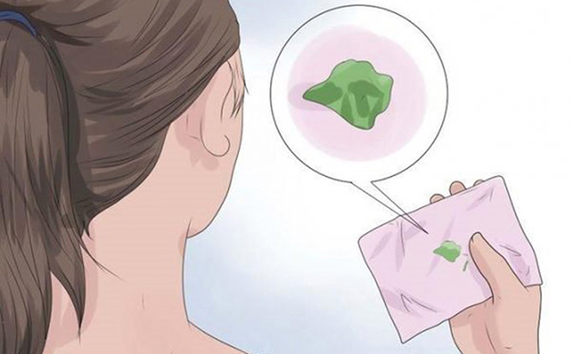 Khí hư có màu, mùi lạ cho thấy âm đạo đang bị viêm nhiễm, tổn thương do sự tấn công của virus, vi khuẩn, trùng, tạp khuẩn,...