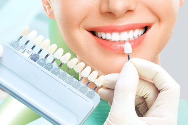Phục hình răng sứ thẩm mỹ là các kỹ thuật giúp cải thiện vẻ đẹp của hàm răng 