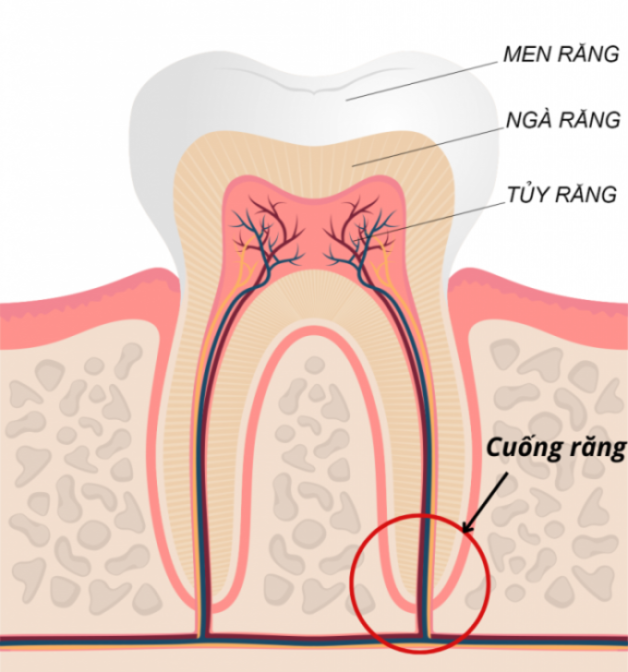 răng viêm quanh cuống