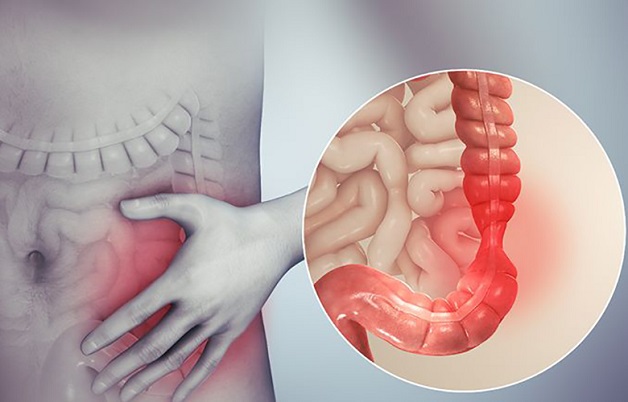 bệnh đường ruột rất phổ biến