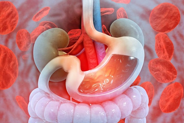biểu hiện của viêm loét dạ dày 