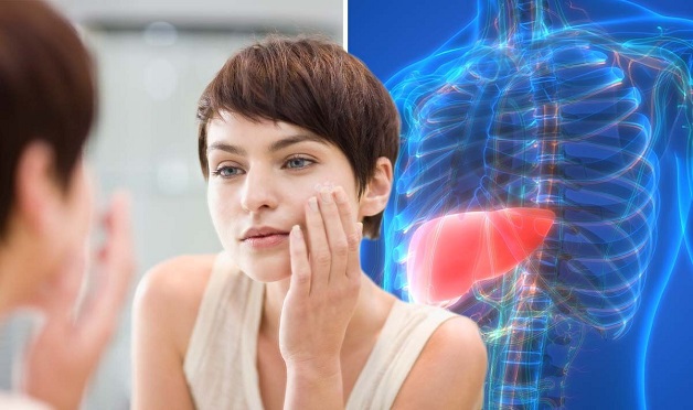 Bệnh gan nhiễm mỡ kiêng gì?