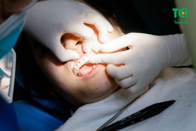 Cách duy nhất để giải quyết gọn gàng tình trạng này là thăm khám trực tiếp với chuyên gia