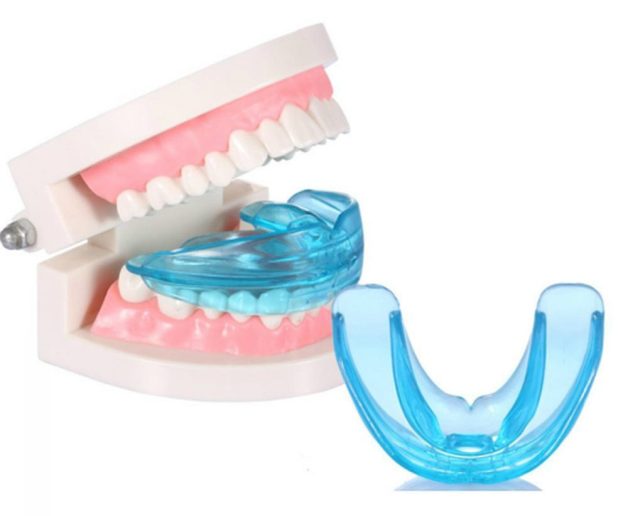 nắn chỉnh răng cho trẻ em