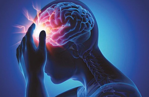 Bệnh lý mạch máu não là vấn đề sức khỏe hết sức nguy hiểm