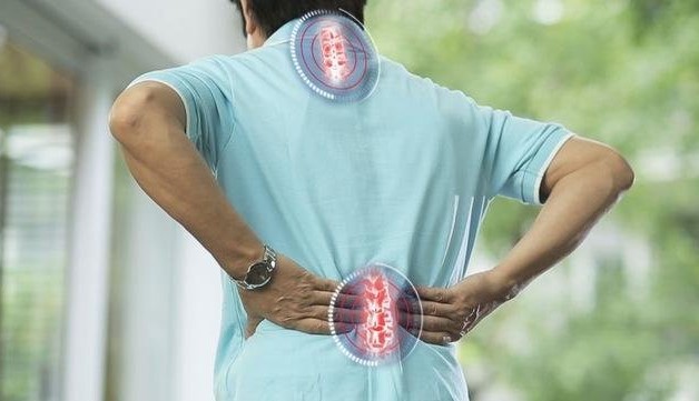 Vôi hóa thường xuất hiện ở vùng cổ và thắt lưng