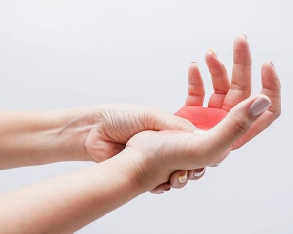 Tê cổ tay, bàn tay dấu hiệu điển hình của hội chứng ống cổ tay