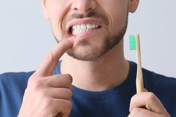 Vệ sinh răng mỗi ngày đặc biệt là sau khi ăn uống để ngăn ngừa mảng bám có thể gây sâu răng