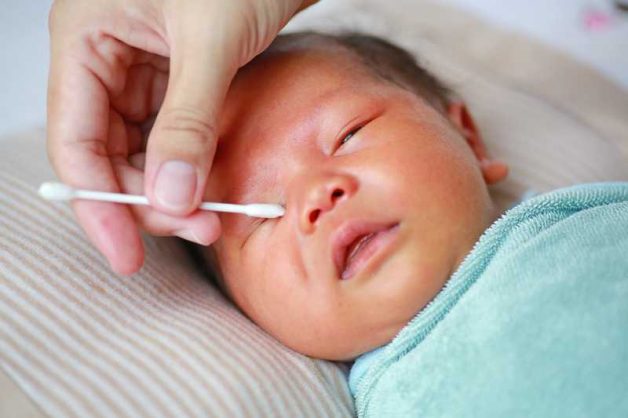 đau mắt đỏ ở trẻ sơ sinh