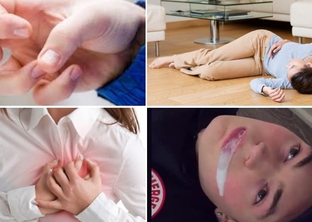 Một số biểu hiện của co giật cục bộ