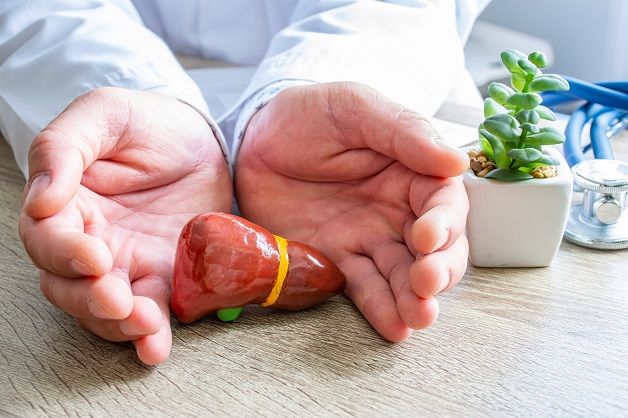 Gan nhiễm mỡ độ 1