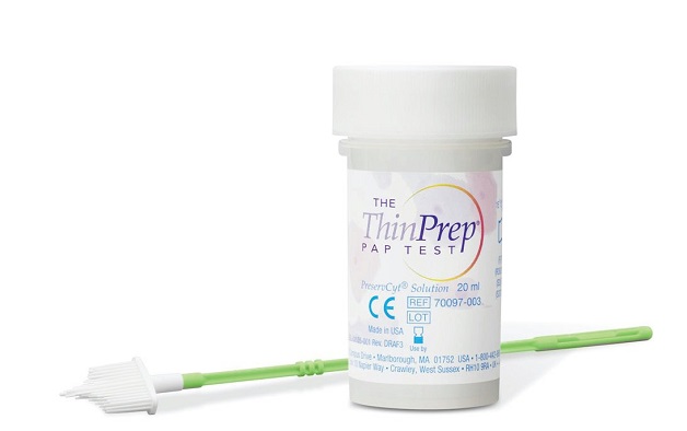 tầm soát ung thư cổ tử cung thinprep
