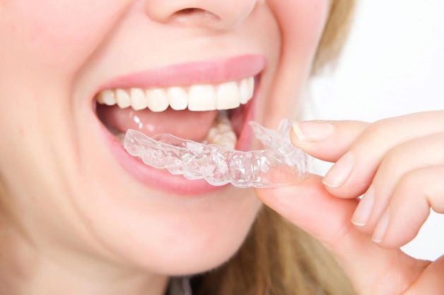 chăm sóc răng sau niềng