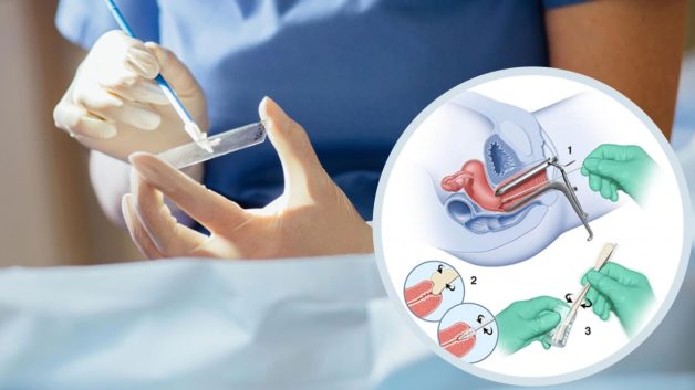 Phương pháp xét nghiệm Pap Smear