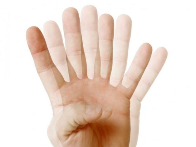 khái niệm loạn thị ở trẻ nhỏ