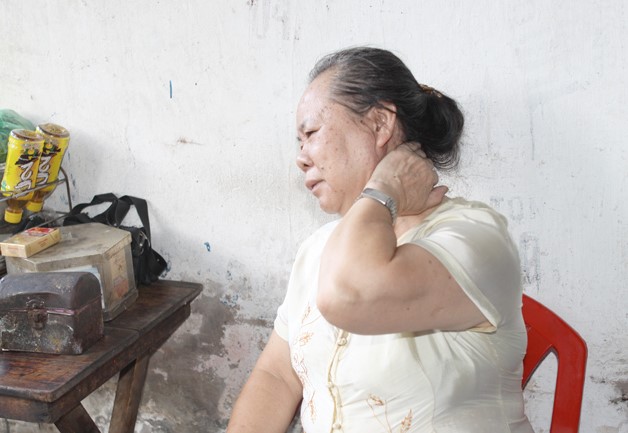 Người lớn tuổi có tỷ lệ mắc vôi sống đốt cổ cao hơn