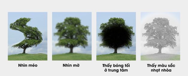 thị lực kém