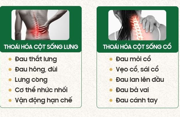 Một số triệu chứng ở cổ và thắt lưng của bệnh thoái hóa