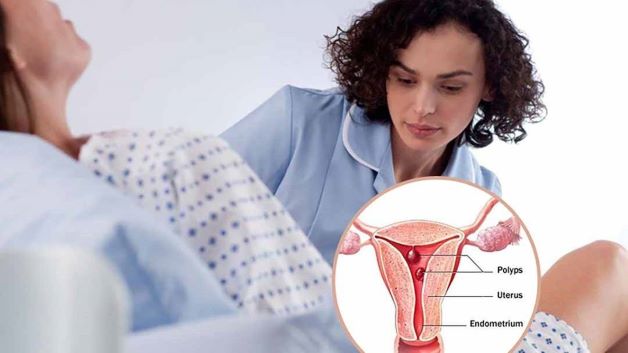 Bệnh polyp tử cung nếu không được phát hiện và điều trị kịp thời có thể biến chứng thành ác tính gây nguy hiểm tới sức khỏe người bệnh