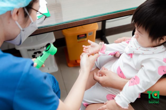 Tìm kiếm sự giúp đỡ của chuyên gia ngay khi trẻ mắc tay chân miệng