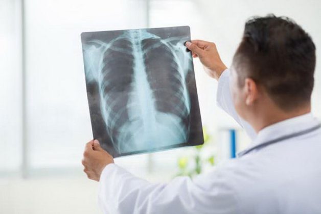 Biến chứng thủy đậu ở trẻ em v