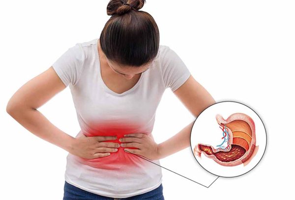 Khi nào nên trị viêm loét dạ dày tại nhà