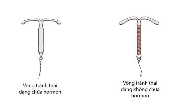 dây vòng tránh thai làm bằng chất liệu gì hiệu quả