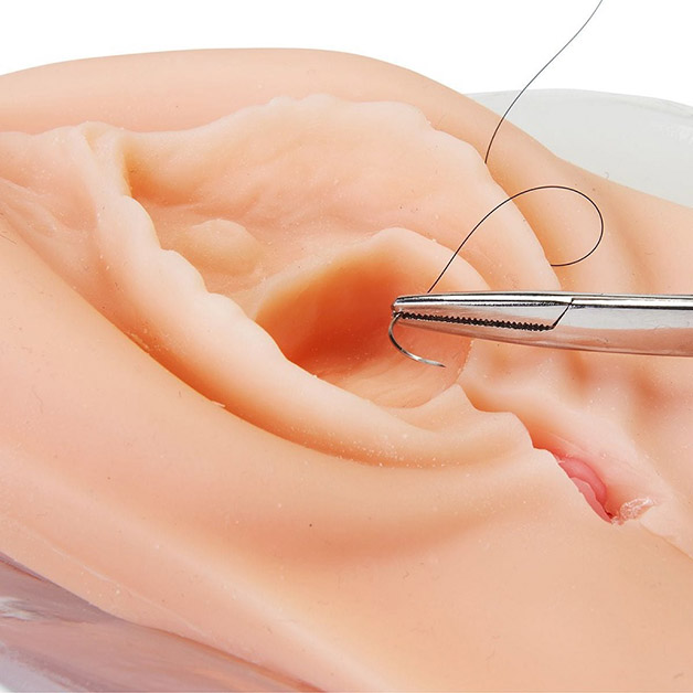 Khâu tầng sinh môn được thực hiện sau cuộc sinh thường, cố định lại vết rạch tầng sinh môn mà không cần loại bỏ các mô da thừa