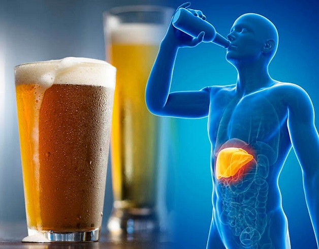 Hạn chế rượu để điều trị gan nhiễm mỡ độ 1