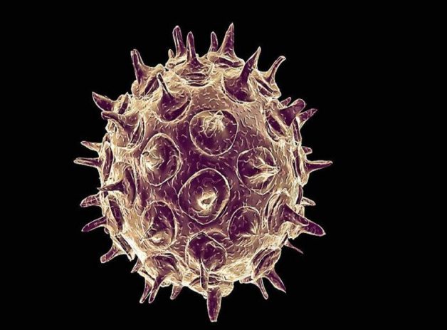 Thủy đậu khởi phát do virus Varicella – Zoster