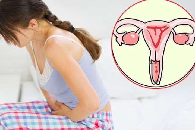 Khi nào nên thực hiện sàng lọc ung thư tử cung