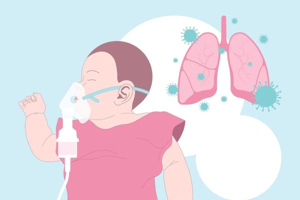 Triệu chứng viêm thanh khí phế quản do virus ở trẻ thường là thở khò khè, sốt nhẹ, nuốt khó...