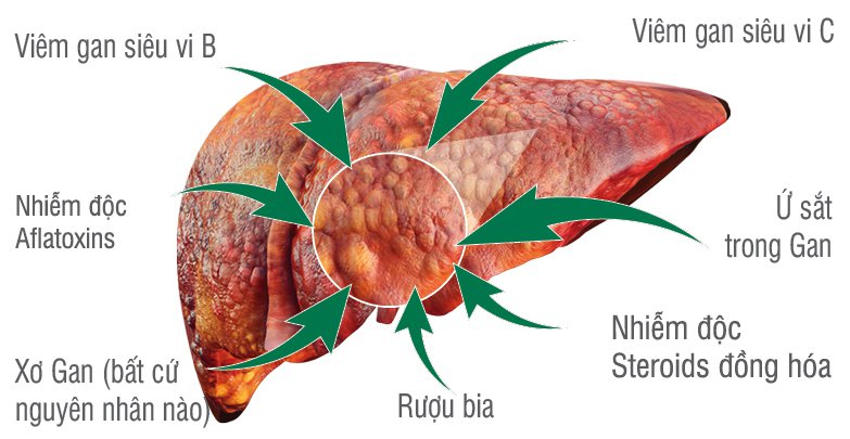 Tầm soát ung thư ở đâu