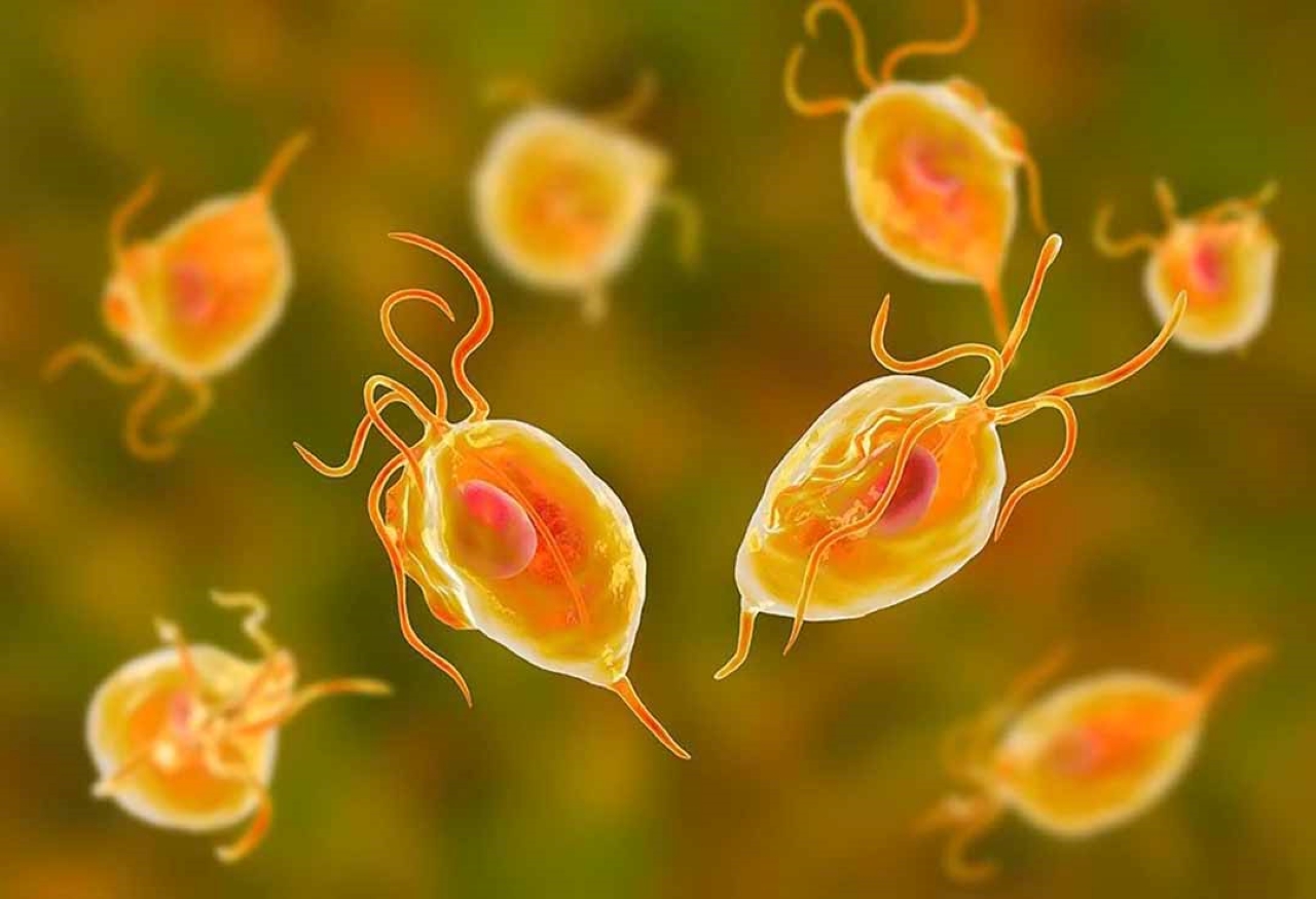 Nhiễm trùng roi âm đạo là bệnh do ký sinh trùng loại trùng roi Trichomonas vaginalis gây ra