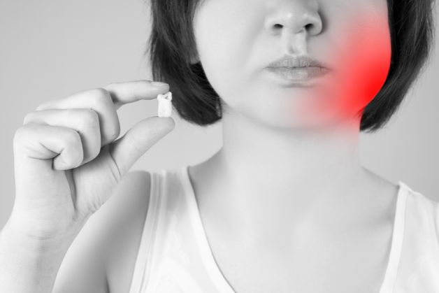 Cần lưu ý gì khi chăm sóc sau nhổ răng hàm?