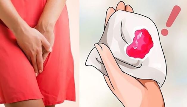 Xuất huyết âm đạo bất thường là một trong những dấu hiệu chửa ngoài dạ con ở giai đoạn đầu